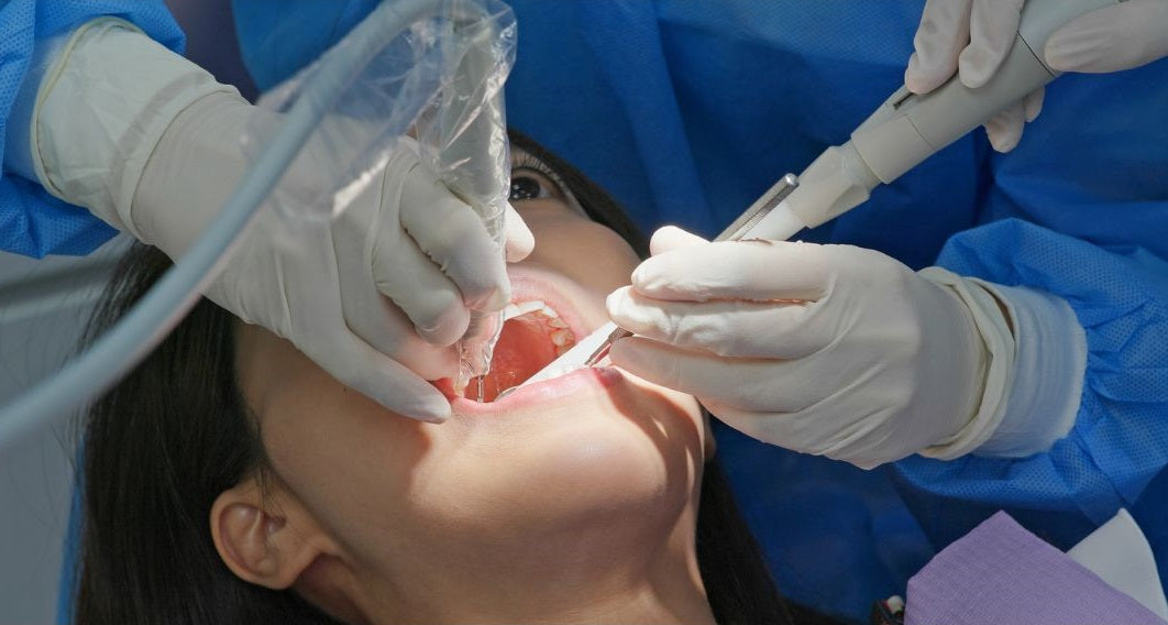 Professionelle Zahnreinigung: Muss das sein oder alles nur Geldmacherei?